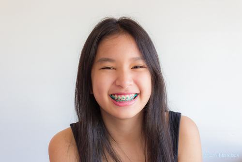 Fix Your Child’s Bad Bite and Relieve Their TMJ With the Help of Orthodontics