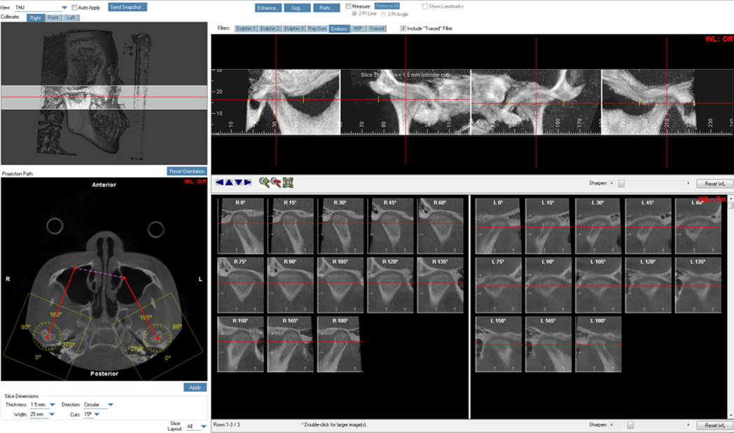 Jaw joint analysis