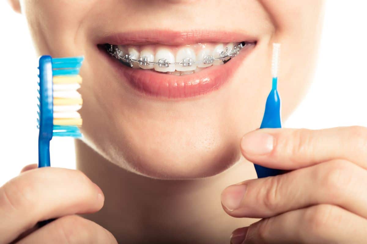 Life with Braces: Essential Tips and Tricks from OPDSF Ortho, San Francisco, CA