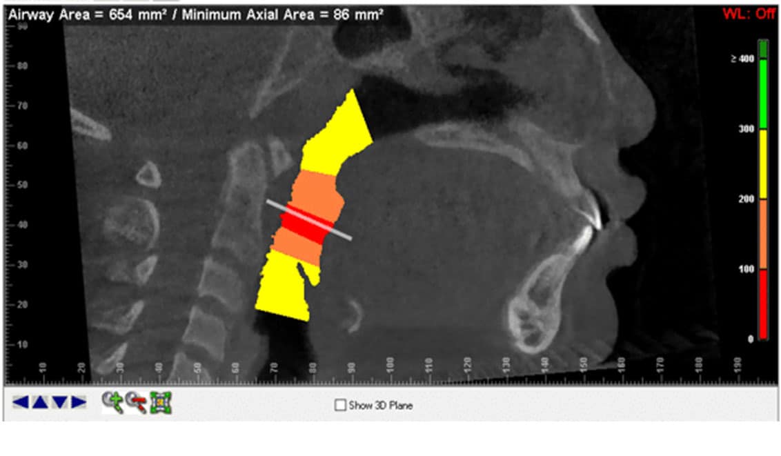 CBCT 8