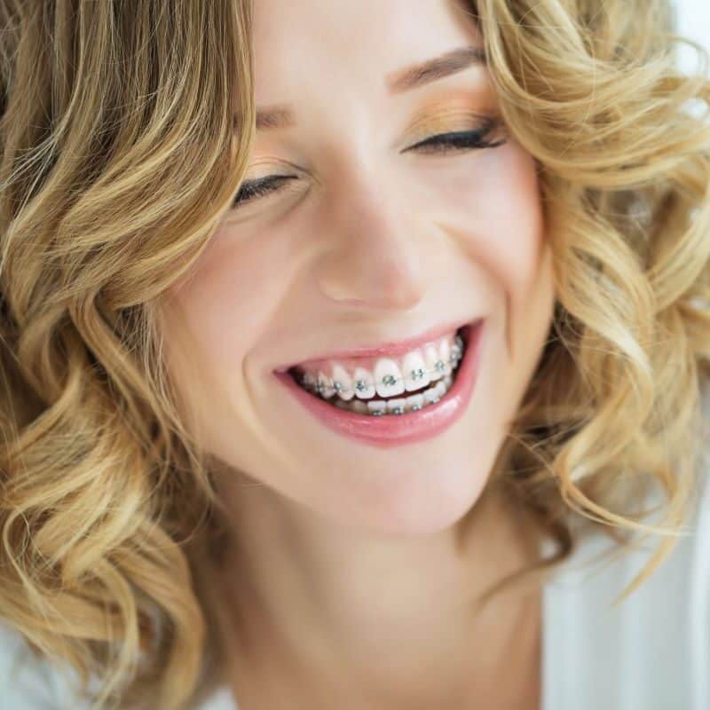 Woman with braces smiling confidently in San Francisco, California