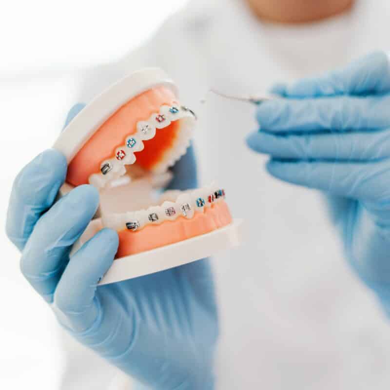 Dentist holding braces model and dental tool.